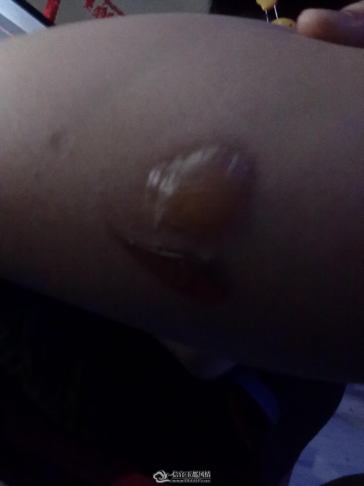 20110727095.jpg