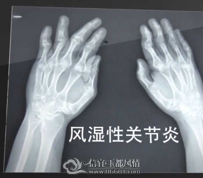 QQ��ͼ20150409103823.jpg
