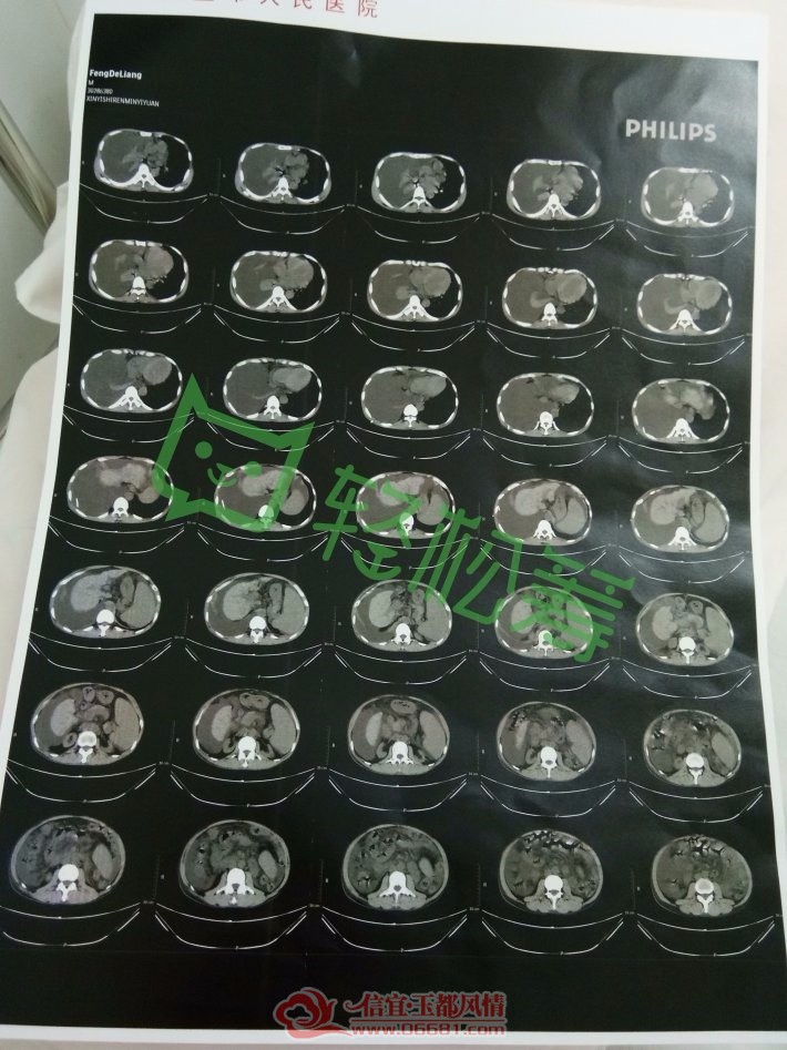 mmexport1533481486899.jpg