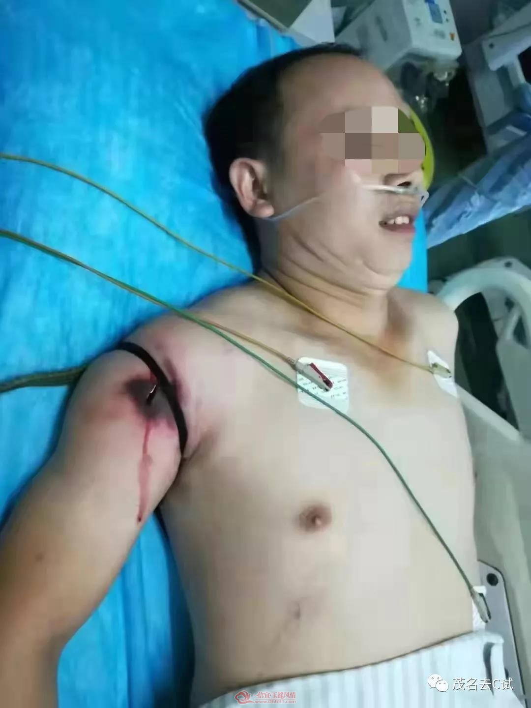 ï��΢��Ⱥ������һ�������߱�ҧ������Ѿ�����
