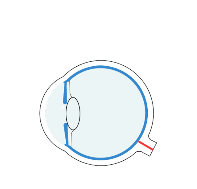 1.gif