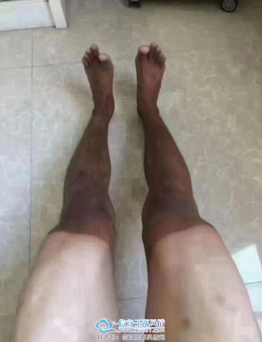 ΢��ͼƬ_20230605112204.png